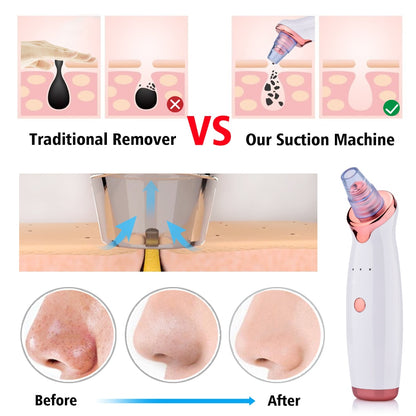 Blackhead Pro Suction