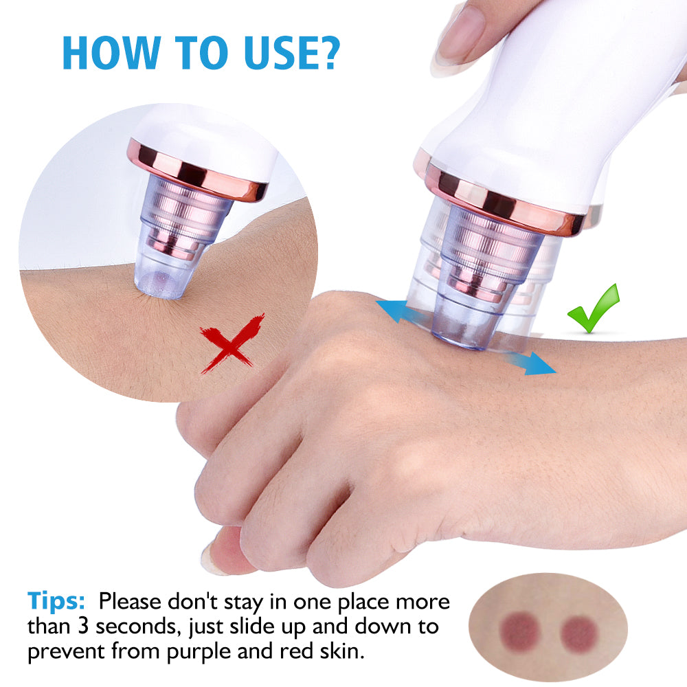 Blackhead Pro Suction
