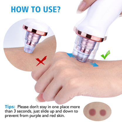 Blackhead Pro Suction